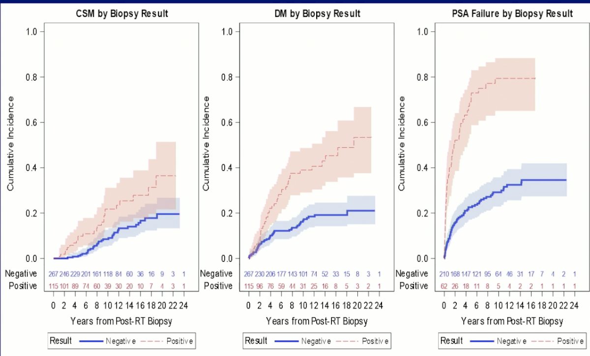 ASTRO 2022: Superior Post-Treatment Biopsy Outcomes With High Dose SBRT ...